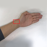 요골동맥 위치 표시